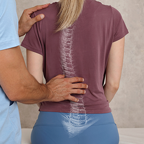 Scoliosis Treatment Calgary - Optimum Wellness Centres