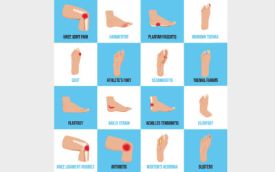 Foot And Toe Deformities