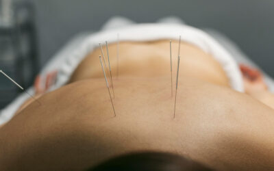 Top 5 Reasons Patients Seek Acupuncture