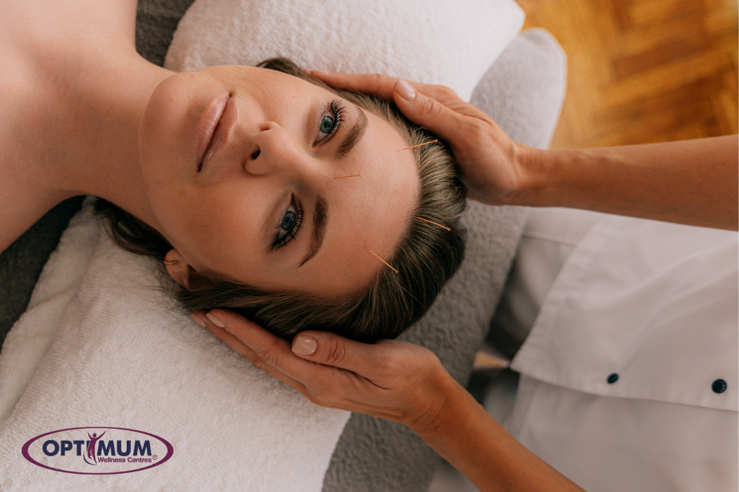 Jaylan-Optimum Wellness Posts – Template (1) Cosmetic Acupuncture session